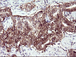 m11627 anti rassf8 mouse monoclonal antibody clone id oti1f5 ihc testing 7