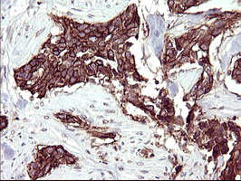 m11627 anti rassf8 mouse monoclonal antibody clone id oti1f5 ihc testing 8