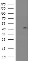 HEK293T cells were transfected with the pCMV6-ENTRY control (Left lane) or pCMV6-ENTRY RASSF8 (Right lane) cDNA for 48 hrs and lysed
