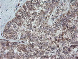 m11629 anti trappc4 mouse monoclonal antibody clone id oti2e1 ihc testing 2
