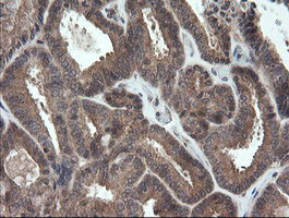 m11629 anti trappc4 mouse monoclonal antibody clone id oti2e1 ihc testing 5