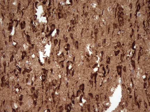 Immunohistochemical staining of paraffin-embedded Human adult brain tissue using anti-FARSB mouse monoclonal antibody