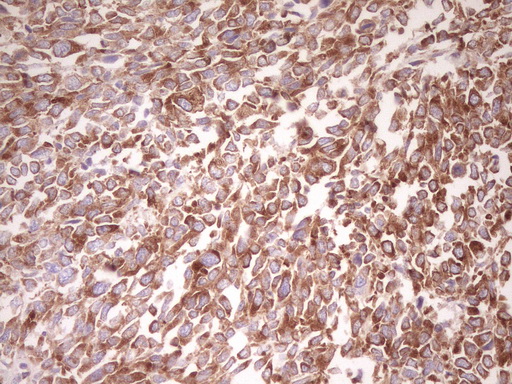 m11656 anti farslb farsb mouse monoclonal antibody clone id oti4b3 ihc testing 4