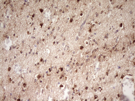 m11656 anti farslb farsb mouse monoclonal antibody clone id oti4b3 ihc testing 6