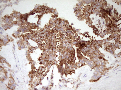 m11656 anti farslb farsb mouse monoclonal antibody clone id oti4b3 ihc testing 7