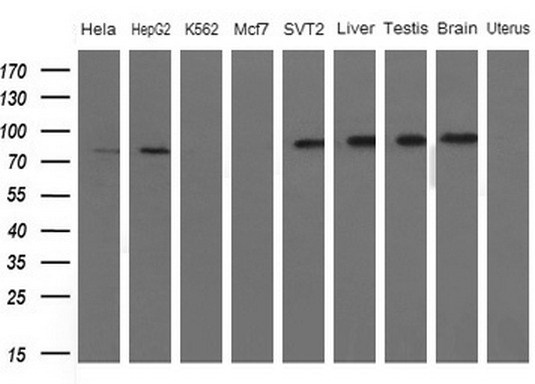 Western blot analysis of extracts (10ug) from 5 different cell lines and 4 human tissue by using anti-FARSB monoclonal antibody (1: Hela; 2: HepG2; 3: K562; 4: Mcf7; 5: SVT2; 6: Liver; 7: Testis; 8: Brain; 9: Uterus) at 1:200 dilution
