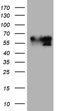 HEK293T cells were transfected with the pCMV6-ENTRY control (Left lane) or pCMV6-ENTRY BNIPL (Right lane) cDNA for 48 hrs and lysed