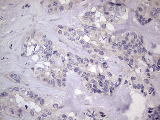 m11704 anti murf3 trim54 mouse monoclonal antibody clone id oti7f8 ihc testing 10