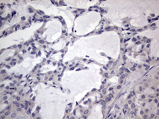 m11704 anti murf3 trim54 mouse monoclonal antibody clone id oti7f8 ihc testing 2