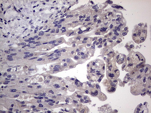 m11704 anti murf3 trim54 mouse monoclonal antibody clone id oti7f8 ihc testing 3