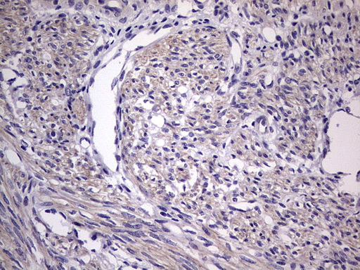 m11704 anti murf3 trim54 mouse monoclonal antibody clone id oti7f8 ihc testing 4