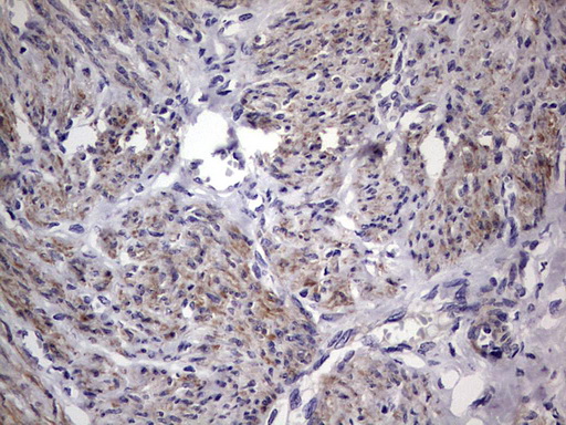 m11704 anti murf3 trim54 mouse monoclonal antibody clone id oti7f8 ihc testing 5