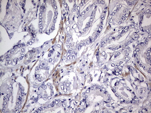 m11704 anti murf3 trim54 mouse monoclonal antibody clone id oti7f8 ihc testing 6
