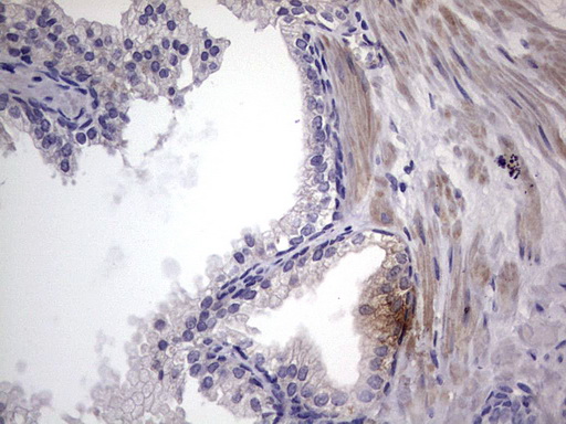 m11704 anti murf3 trim54 mouse monoclonal antibody clone id oti7f8 ihc testing 7