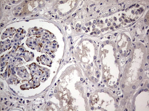 m11704 anti murf3 trim54 mouse monoclonal antibody clone id oti7f8 ihc testing 9