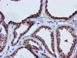 m11709 anti lactb2 mouse monoclonal antibody clone id oti2f9 ihc testing 4