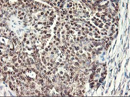 m11760 anti als2cr1 nif3l1 mouse monoclonal antibody clone id oti5a7 ihc testing 4