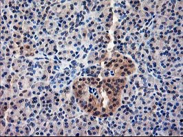 m11760 anti als2cr1 nif3l1 mouse monoclonal antibody clone id oti5a7 ihc testing 5