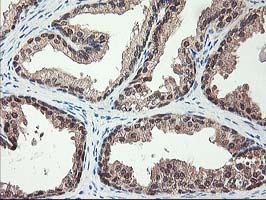 m11760 anti als2cr1 nif3l1 mouse monoclonal antibody clone id oti5a7 ihc testing 7