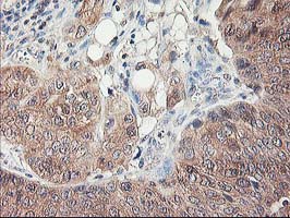 m11760 anti als2cr1 nif3l1 mouse monoclonal antibody clone id oti5a7 ihc testing 9