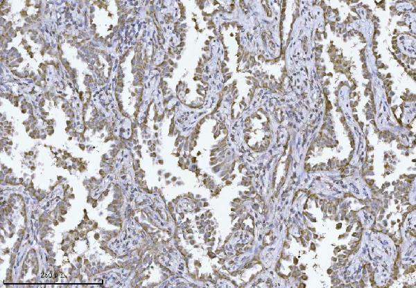 m11793 pmpcb primary antibodies ihc testing 2