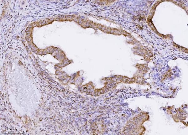 m11793 pmpcb primary antibodies ihc testing 3