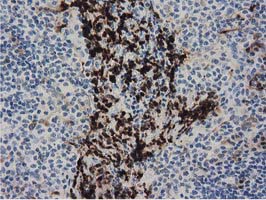m11798 1 anti ppwd1 mouse monoclonal antibody clone id oti1b8 ihc testing 2