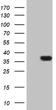 HEK293T cells were transfected with the pCMV6-ENTRY control (Left lane) or pCMV6-ENTRY PSMG2 (Right lane) cDNA for 48 hrs and lysed. Equivalent amounts of cell lysates (5 ug per lane) were separated by SDS-PAGE and immunoblotted with anti-PSMG2 (1:2000).