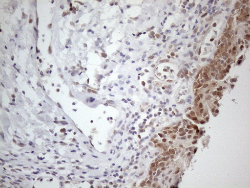 Immunohistochemical staining of paraffin-embedded Human bladder tissue within the normal limits using anti-PSMG2 mouse monoclonal antibody