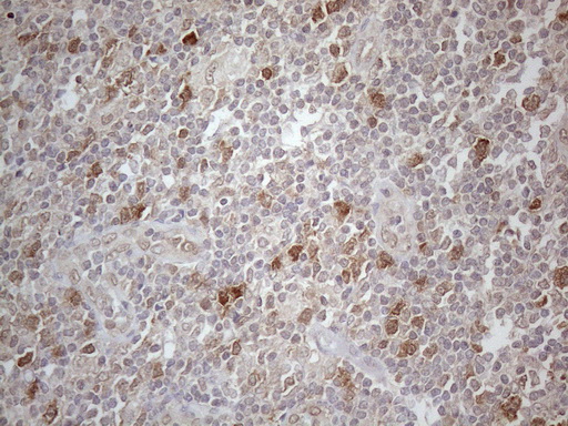 Immunohistochemical staining of paraffin-embedded Human lymph node tissue within the normal limits using anti-PSMG2 mouse monoclonal antibody