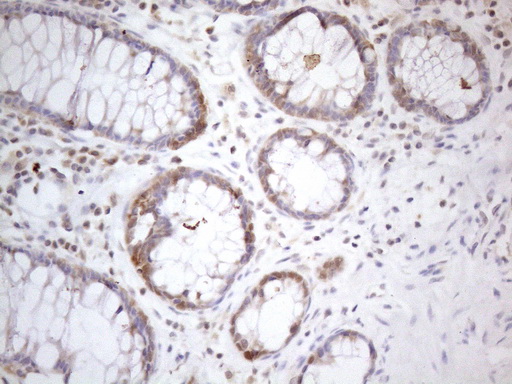 m11804 anti psmg2 mouse monoclonal antibody clone id oti1e8 ihc testing 5