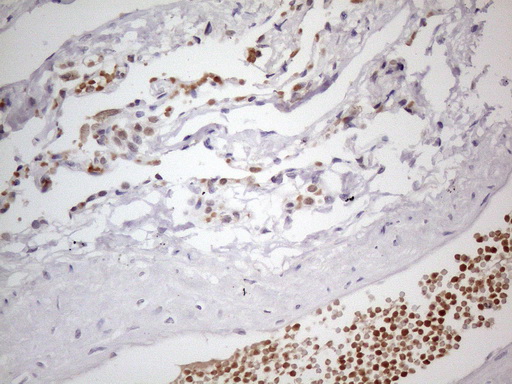 m11804 anti psmg2 mouse monoclonal antibody clone id oti1e8 ihc testing 7