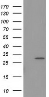 HEK293T cells were transfected with the pCMV6-ENTRY control (Left lane) or pCMV6-ENTRY BIN3 (Right lane) cDNA for 48 hrs and lysed
