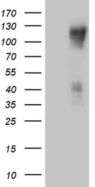 HEK293T cells were transfected with the pCMV6-ENTRY control (Left lane) or pCMV6-ENTRY PODXL2 (Right lane) cDNA for 48 hrs and lysed