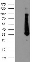 HEK293T cells were transfected with the pCMV6-ENTRY control (Left lane) or pCMV6-ENTRY FAM119A (Right lane) cDNA for 48 hrs and lysed
