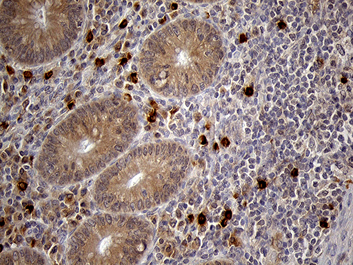 Immunohistochemical staining of paraffin-embedded Human appendix tissue within the normal limits using anti-FOLR3 mouse monoclonal antibody