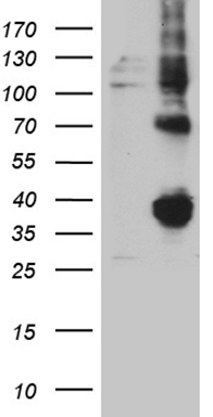HEK293T cells were transfected with the pCMV6-ENTRY control (Left lane) or pCMV6-ENTRY FOLR3 (Right lane) cDNA for 48 hrs and lysed