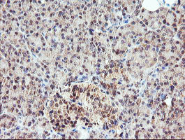 Immunohistochemical staining of paraffin-embedded Human pancreas tissue within the normal limits using anti-MEIS3 mouse monoclonal antibody