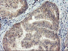 m11850 1 anti meis homeobox 3 meis3 mouse monoclonal antibody clone id oti2e12 ihc testing 4