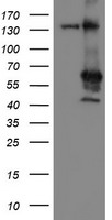 HEK293T cells were transfected with the pCMV6-ENTRY control (Left lane) or pCMV6-ENTRY MEIS3 (Right lane) cDNA for 48 hrs and lysed