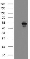 HEK293T cells were transfected with the pCMV6-ENTRY control (Left lane) or pCMV6-ENTRY MEIS3 (Right lane) cDNA for 48 hrs and lysed