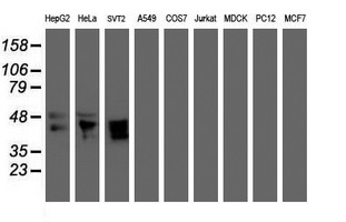 Western blot analysis of extracts (35ug) from 9 different cell lines by using anti-MEIS3 monoclonal antibody (HepG2: human; HeLa: human; SVT2: mouse; A549: human; COS7: monkey; Jurkat: human; MDCK: canine; PC12: rat; MCF7: human)