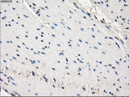 m11862 anti slc2a6 mouse monoclonal antibody clone id oti7e3 ihc testing 6