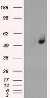 HEK293T cells were transfected with the pCMV6-ENTRY control (Left lane) or pCMV6-ENTRY SLC2A6 (Right lane) cDNA for 48 hrs and lysed