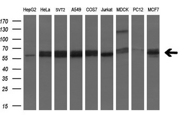 Western blot analysis of extracts (35ug) from 9 different cell lines by using anti-SLC2A6 monoclonal antibody (HepG2: human; HeLa: human; SVT2: mouse; A549: human; COS7: monkey; Jurkat: human; MDCK: canine; PC12: rat; MCF7: human) (1:200)