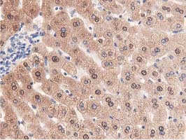 Immunohistochemical staining of paraffin-embedded Human liver tissue within the normal limits using anti-PRPSAP2 mouse monoclonal antibody. (Heat-induced epitope retrieval by 10mM citric buffer