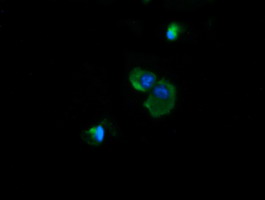 m11886 1 anti ndufb10 mouse monoclonal antibody clone id oti4f1 if testing 10