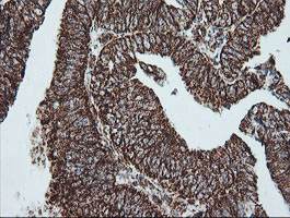 m11886 1 anti ndufb10 mouse monoclonal antibody clone id oti4f1 ihc testing 5