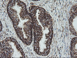 m11886 1 anti ndufb10 mouse monoclonal antibody clone id oti4f1 ihc testing 6