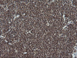 m11886 1 anti ndufb10 mouse monoclonal antibody clone id oti4f1 ihc testing 7